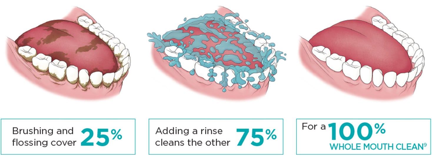 Brushing and flossing cover 25% Adding a rinse cleans 75% for a 100% whole mouth clean